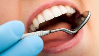 20’lik Diş Çekimi Sonrası Dil Uyuşukluğu